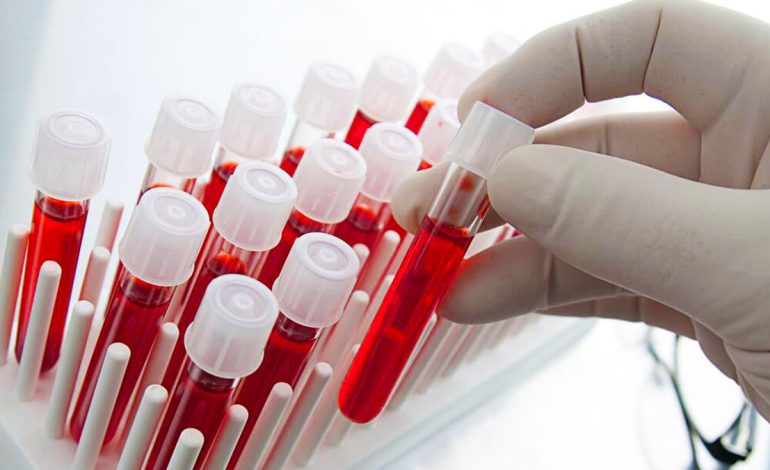 Kur Niveli i Sheqerit në Gjak është i Ulët ose i Lartë – Shenjat si ta Dalloni