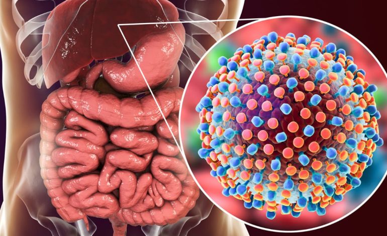 Çfarë Është Hepatiti D? – Informacionet e Rëndësishme që Duhet t’i Dini