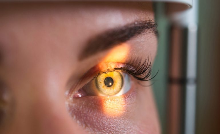 Glaukoma Arsyeja e Dytë Kryesore e Dëmtimit të Shikimit