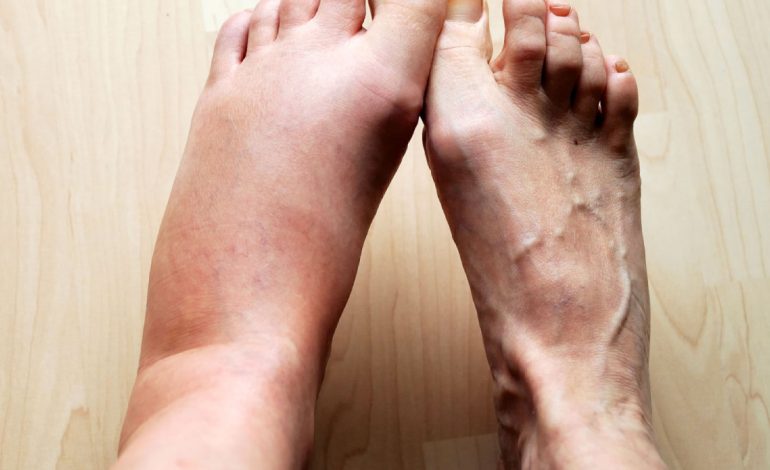 Sekreti për të Zvogëluar Inflamacionin në Trup