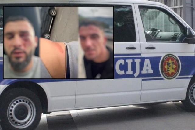 Sulmi i shqiptarëve, reagon ashpër Prokuroria në Malin e Zi