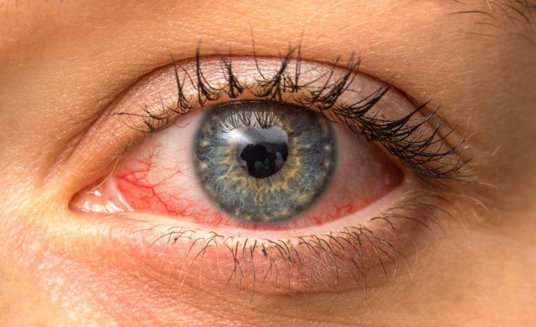 Tharja e Syve nga Telefoni – Kujdesi që Duhet të Tregoni