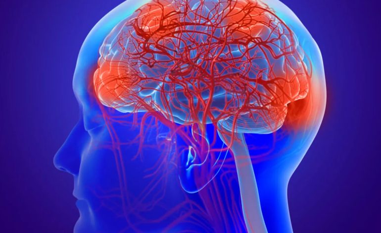 Çfarë Duhet të Bëni Tani për të Parandaluar Demencën