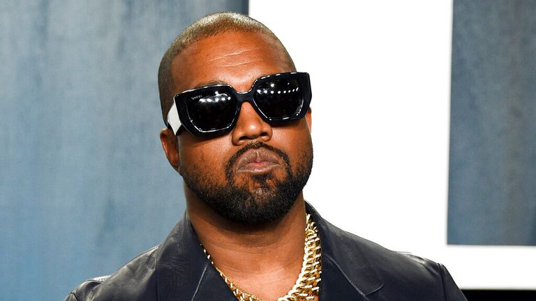 Fansat alarmohen me buzët e Kanye West pas implantit 850 mijë dollarësh