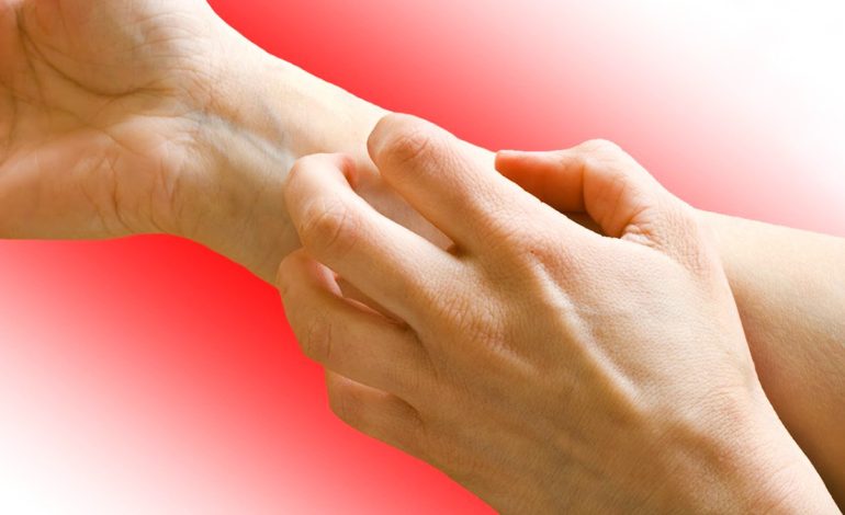 Sinjalet që Jep Ekzema për Problemet me Zemrën – Cilat Janë Kurat Natyrale