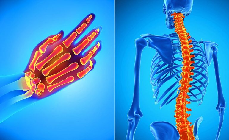 Pse Terapia Manuale Është e Rëndësishme për Personat me Artrit