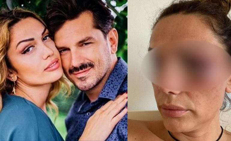 “E kam prek pak”, rrëfimi i këngëtares shqiptare, si e mashtroi burri për dhunën ndaj ish-gruas para se të ishte vetë viktimë: Ajo ishte serbe, dhe…