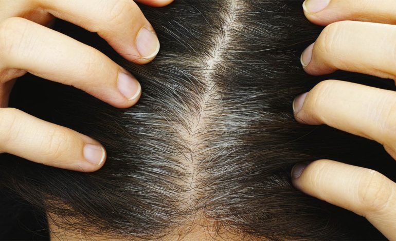 Për Çfarë Përdoret Vitamina B10 Dhe Dozat e Duhura