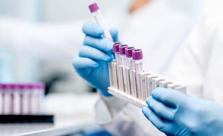 Faktet si Ndryshon Plakja mes Femrave dhe Meshkujve