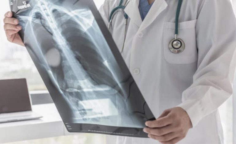 Si Ndikon e Qeshura tek Njerëzit që Vuajnë Nga Astma