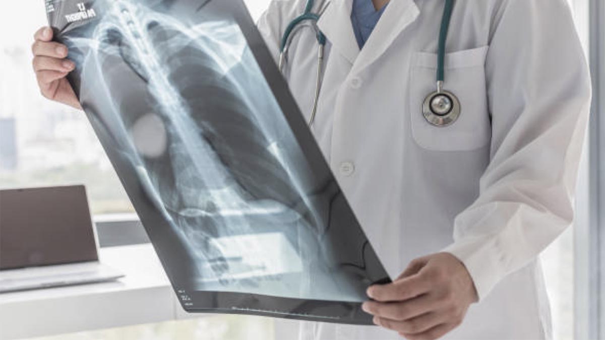 Si Ndikon e Qeshura tek Njerëzit që Vuajnë Nga Astma