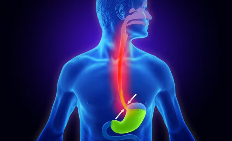 Aciditeti dhe Urthi – Shkaqet dhe Hapat e Thjeshtë për Qetësim