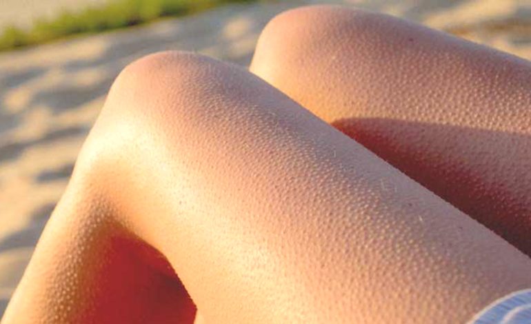 Mornicat në Trup – Arsyet Pse ju Ndodhin Vazhdimisht