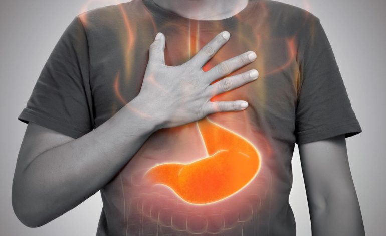 Refluksi Gastroezofageal – Çfarë Duhet të Dini Për Djegien e Stomakut