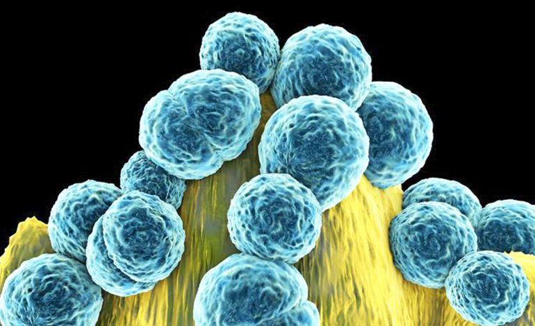 Çfarë Duhet të Dini Rreth Helmimit me Safilokok nga Ushqimi?