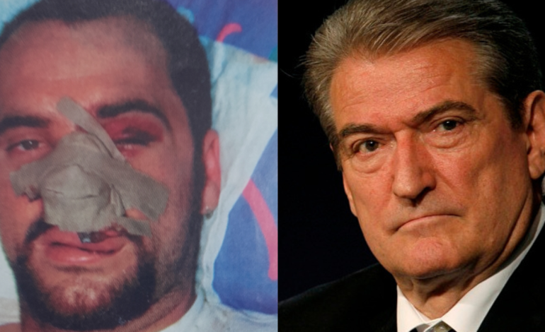 Rama i tregoi gazetarit italian fotografitë kur u dhunua në 1997, reagon Berisha: Po shet krimin e pasionit për krim politik