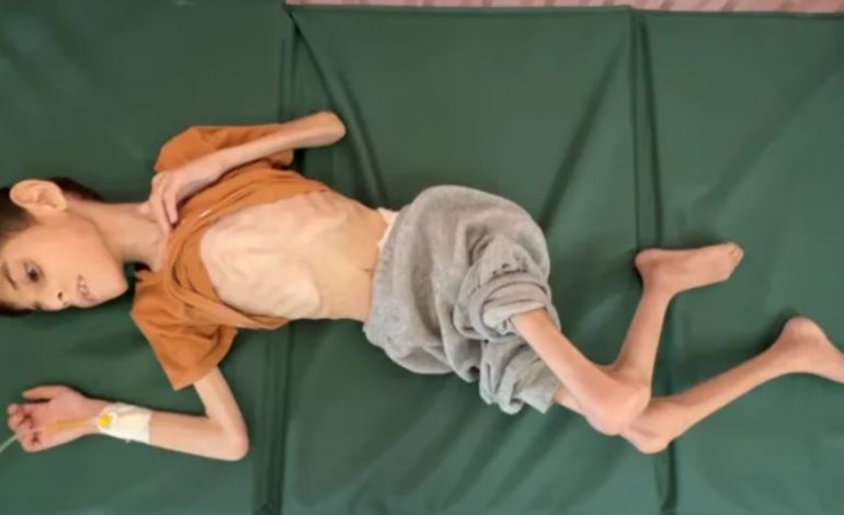 Pamje tronditëse! Fëmijët e gjymtuar nuk flasin dhe lëvizin dot, ndodhen afër vdekjes! Shkak kontaminimi i ujit dhe kequshqyerja në Gaza