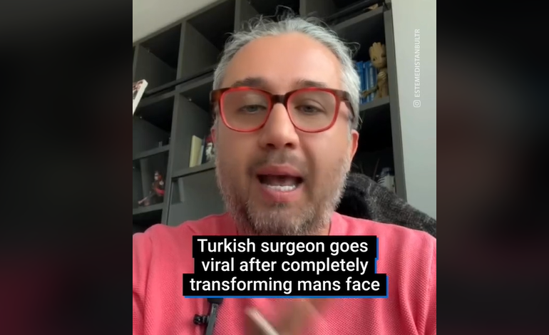 I moshuari transformohet nga operacionet,e vërteta pas pamjeve që po çmendin rrjetin