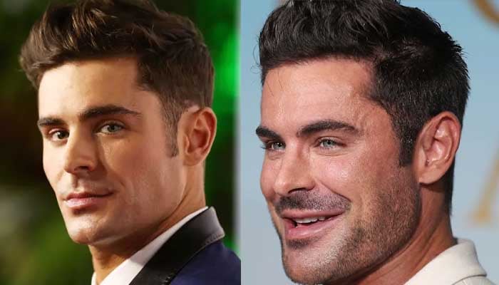 Kirurgu plastik zbulon se çfarë ka ndodhur me fytyrën e Zac Efron