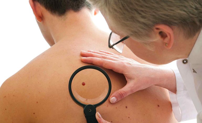 Gjashtë Sëmundjet që Reflektohen në Fytyrë – Shenjat Paralajmëruese