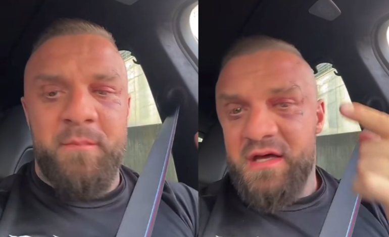 I nxirë dhe me plagë ende të pashëruara ne fytyrë, Medi Iseni publikon video për herë të parë pas sherrit me Noizy-n: Çdo gjë…