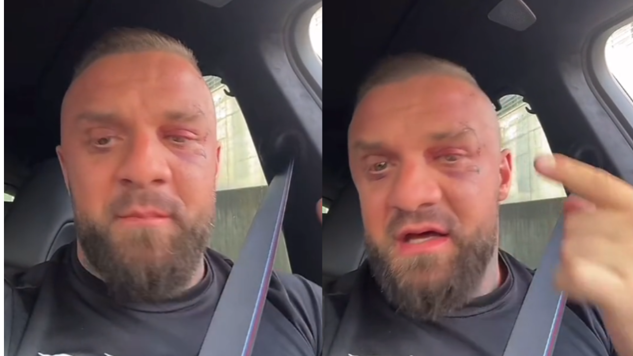 I nxirë dhe me plagë ende të pashëruara ne fytyrë, Medi Iseni publikon video për herë të parë pas sherrit me Noizy-n: Çdo gjë…