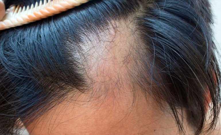 Problemet me Tiroiden tek të Rinjtë – Sinjalet që Jep Trupi