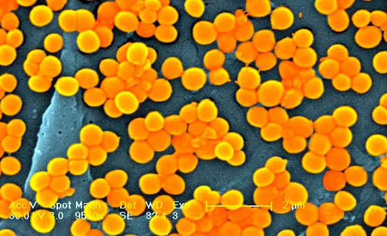 Kriza e superbaktereve mund të përkeqësohet/ Infeksionet po bëhen rezistente ndaj medikamenteve, studimi: Mund të marrë 40 milionë jetë njerëzish deri në vitin 2050