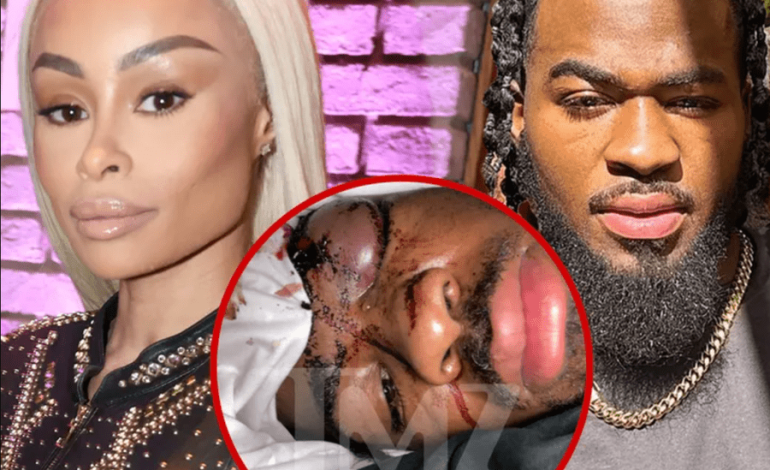 Blac Chyna paditet për dhunë në familje nga ish i dashuri