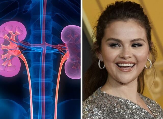 Sëmundja që ndryshoi jetën e Selena Gomez… Çfarë është Lupus?