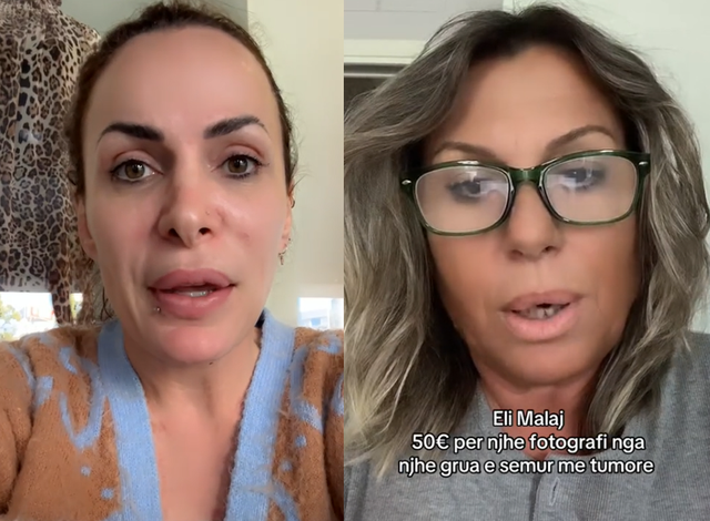 “Kërkoi 50€ për foto”/ Gruaja me kancer akuzon këngëtaren, Eli Malaj: Thirri mendjes