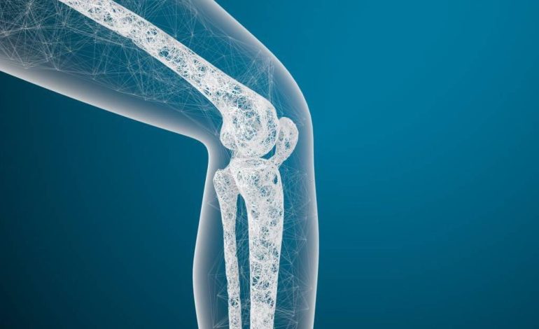 Lidhja mes Artritit dhe Osteoporozës tek Gratë – Këshillat e Mjekëve