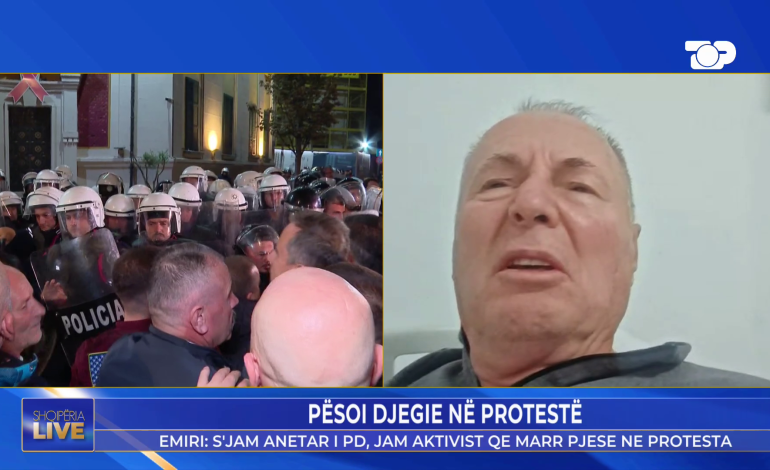 “Kam djegie të gradës së tretë”/ Flet qytetari që u dëmtua nga molotovi dje në protestë: Efektivi i ra me shqelm dhe e hodhi…