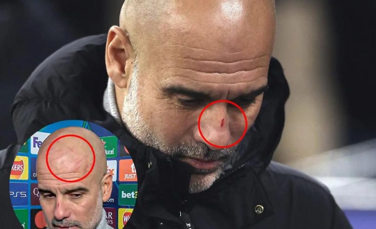 U shfaq i gjakosur pas Feyenoord, shokon Guardiola: Doja t’i bëja keq vetes (VIDEO)