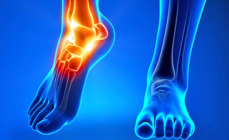 Ndikimi i Reumatizmës te Kyçet e Këmbëve – Kurat Natyrale dhe Ushqimet e Duhura