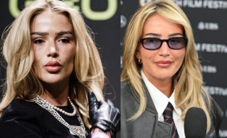 Loredana heq filler-in nga fytyra, a ju pëlqen?
